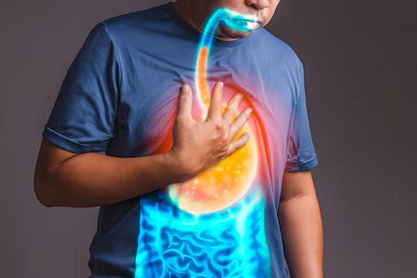 Acidity and Reflux Disorder