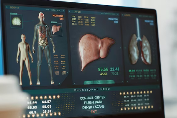 FibroScan