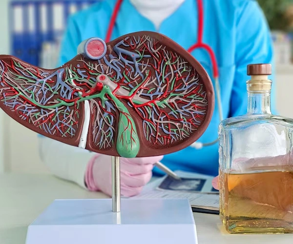 Alcoholic Liver Disease