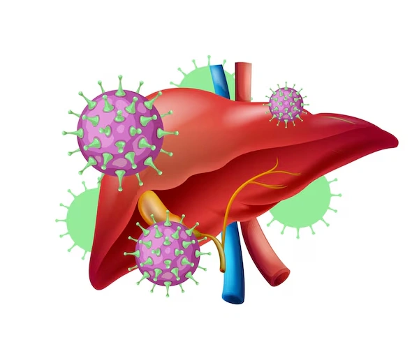 Chronic Hepatitis C