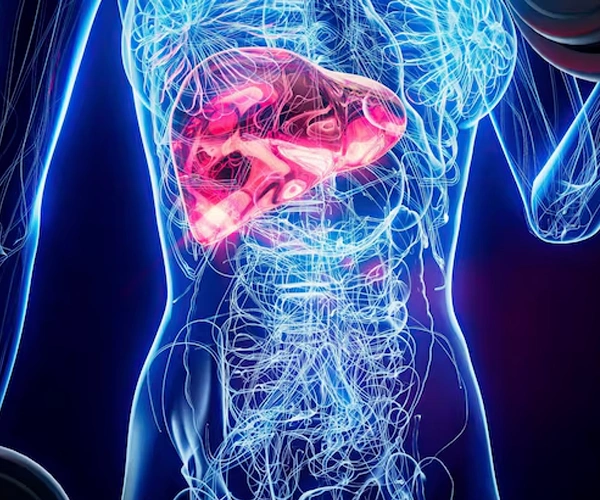 Acute Pancreatitis