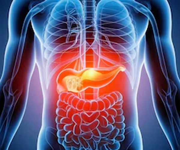 Chronic Pancreatitis