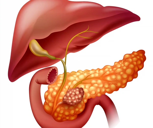 Pancreatic Diseases