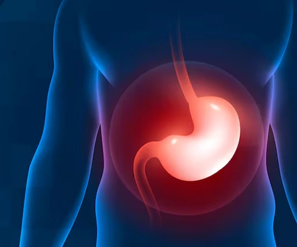 Gastric Cancer