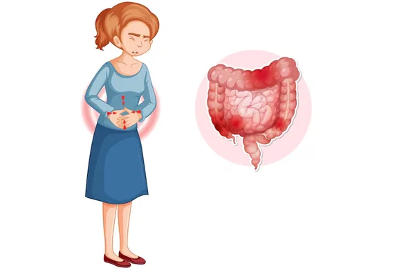 Gastrointestinal Bleeding